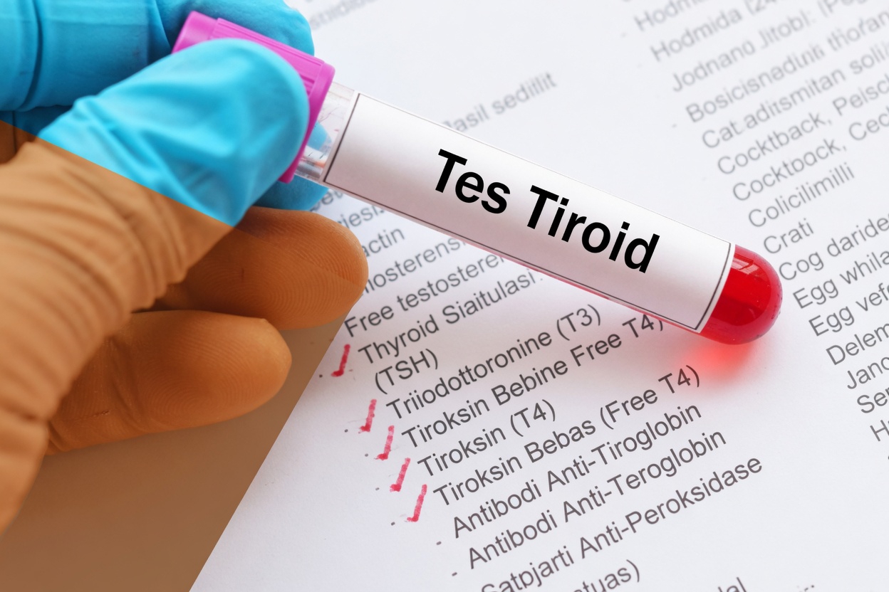 Mengapa Banyak Orang yang Mengonsumsi Levothyroxine Masih Kesulitan – dan Apa yang Jarang Dijelaskan Dokter