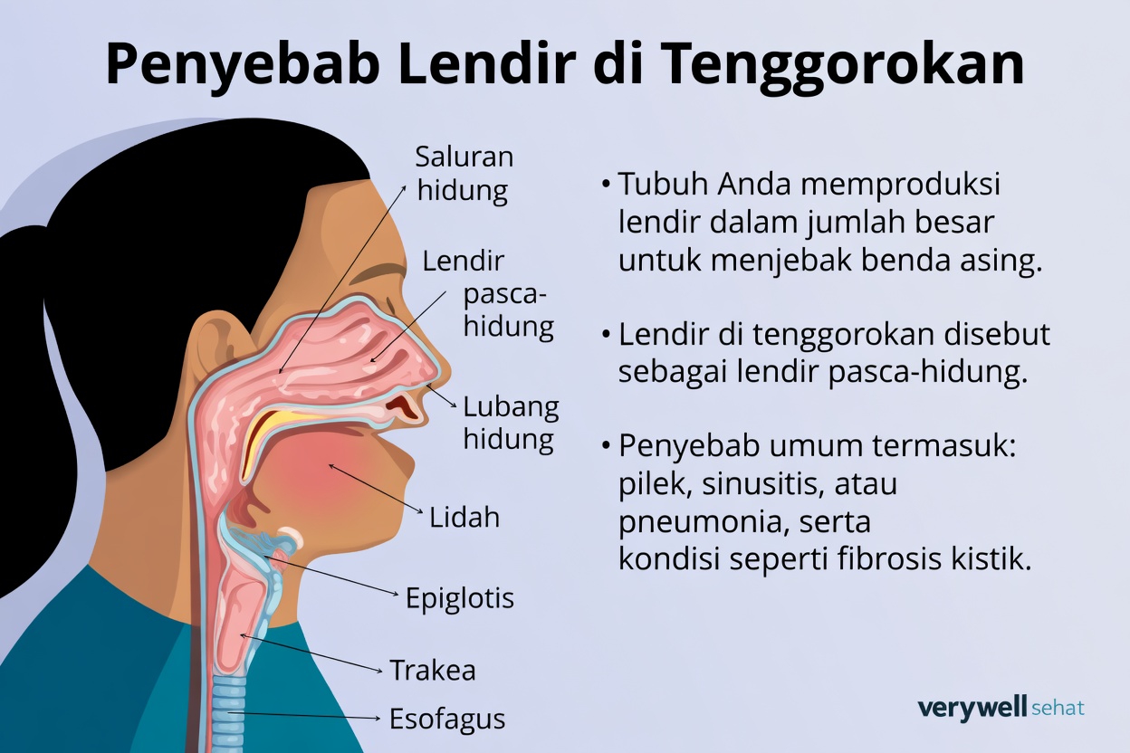 Mengapa Anda Mengalami Dahak yang Terus-Menerus di Tenggorokan dan Faktor-Faktor Sehari-hari yang Perlu Anda Ketahui
