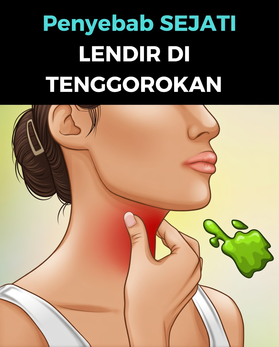 Mengapa Anda Mengalami Dahak yang Terus-Menerus di Tenggorokan dan Faktor-Faktor Sehari-hari yang Perlu Anda Ketahui