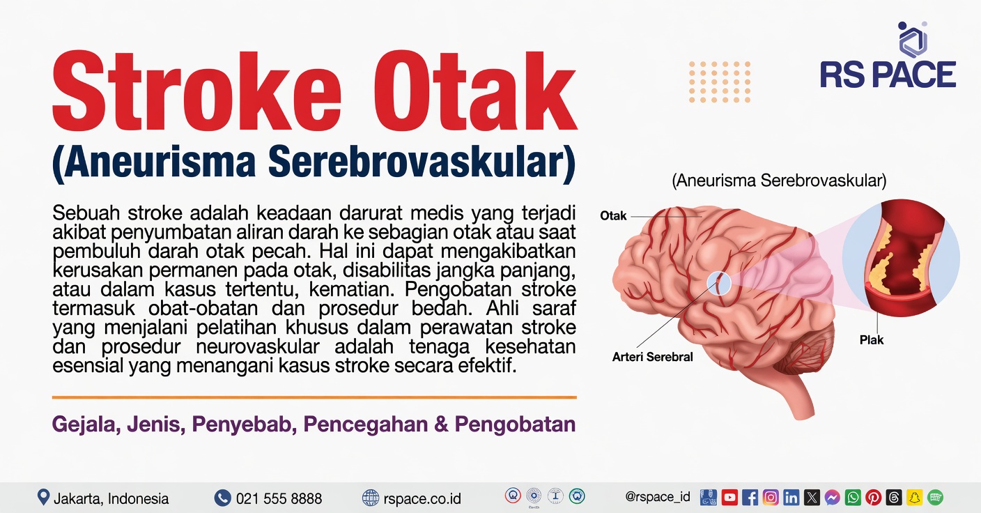Mungkinkah Gejala saat Tidur Ini Menjadi Tanda Peringatan Stroke?
