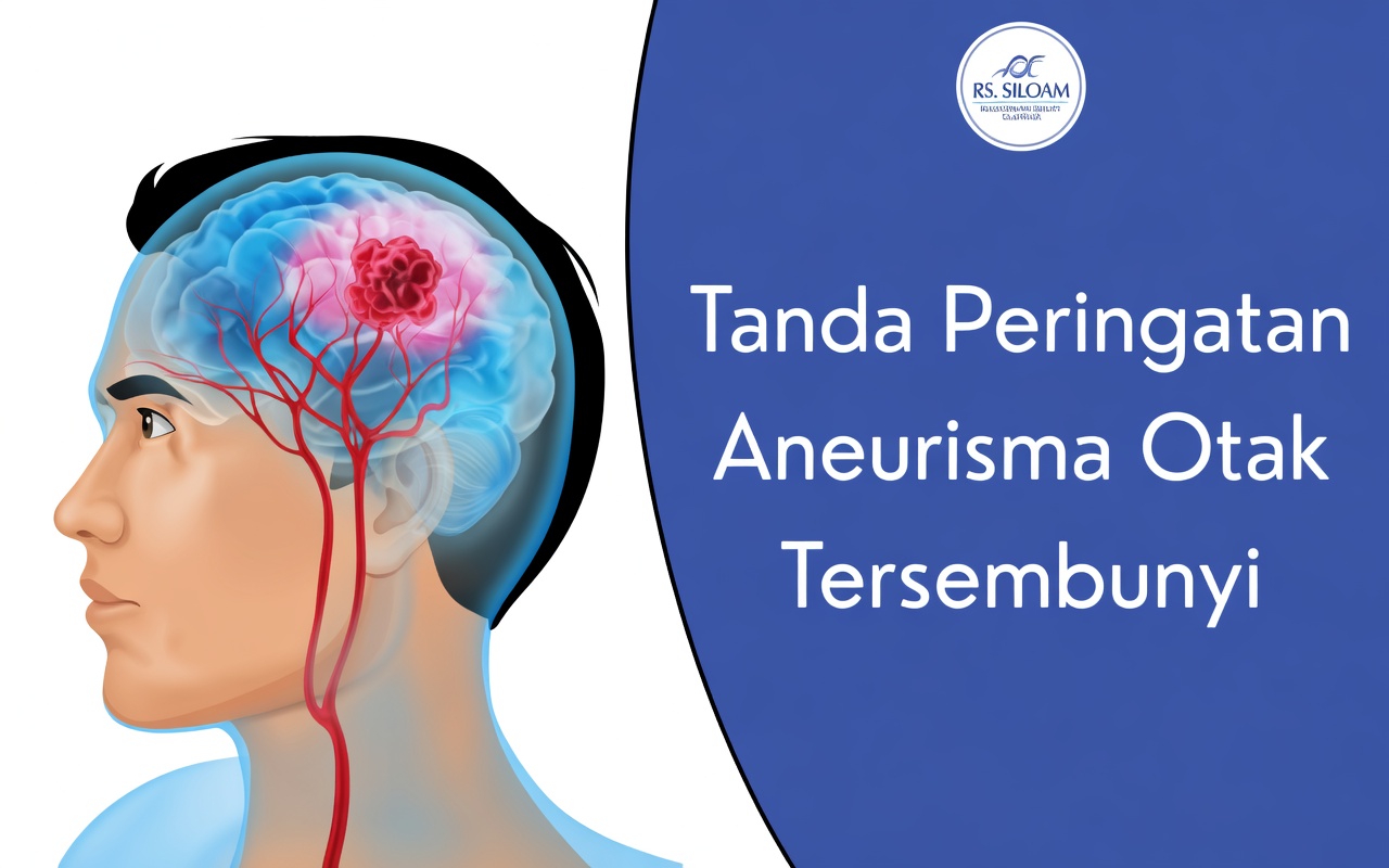 Apa Saja Tanda dan Gejala Aneurisma Otak yang Paling Penting yang Tidak Boleh Anda Abaikan
