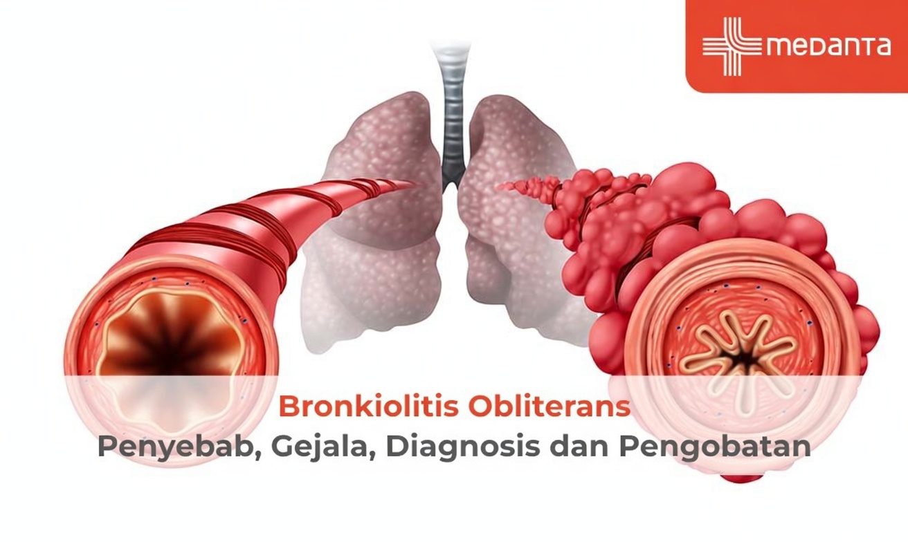 Vaping dan Paru-paru Popcorn: Risiko Tersembunyi yang Masih Diabaikan Banyak Orang Dewasa