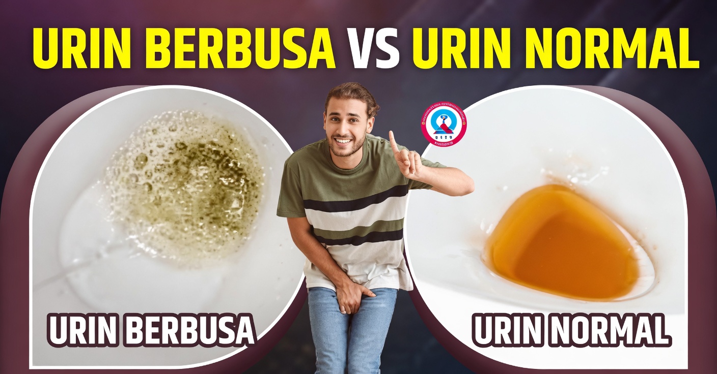 Mengapa Urine Anda Terlihat Berbusa? Memahami Sinyal Umum Kesehatan Ginjal Ini