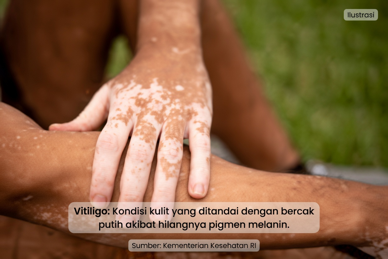 Apa Bintik-Bintik Putih Kecil Ini pada Kulit?