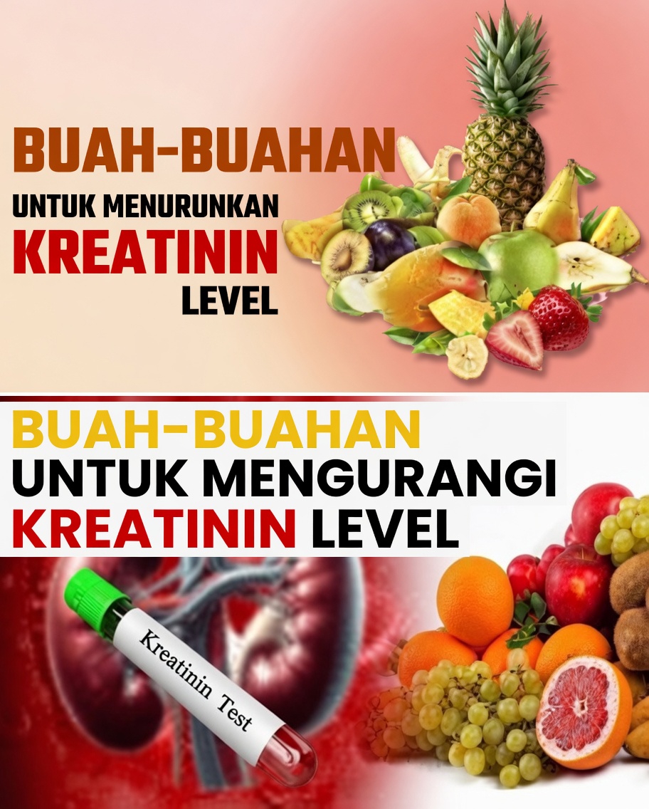 Kadar Kreatinin Tinggi? 4 Buah yang Harus Anda Makan pada Malam Hari untuk Mendukung Kesehatan Ginjal