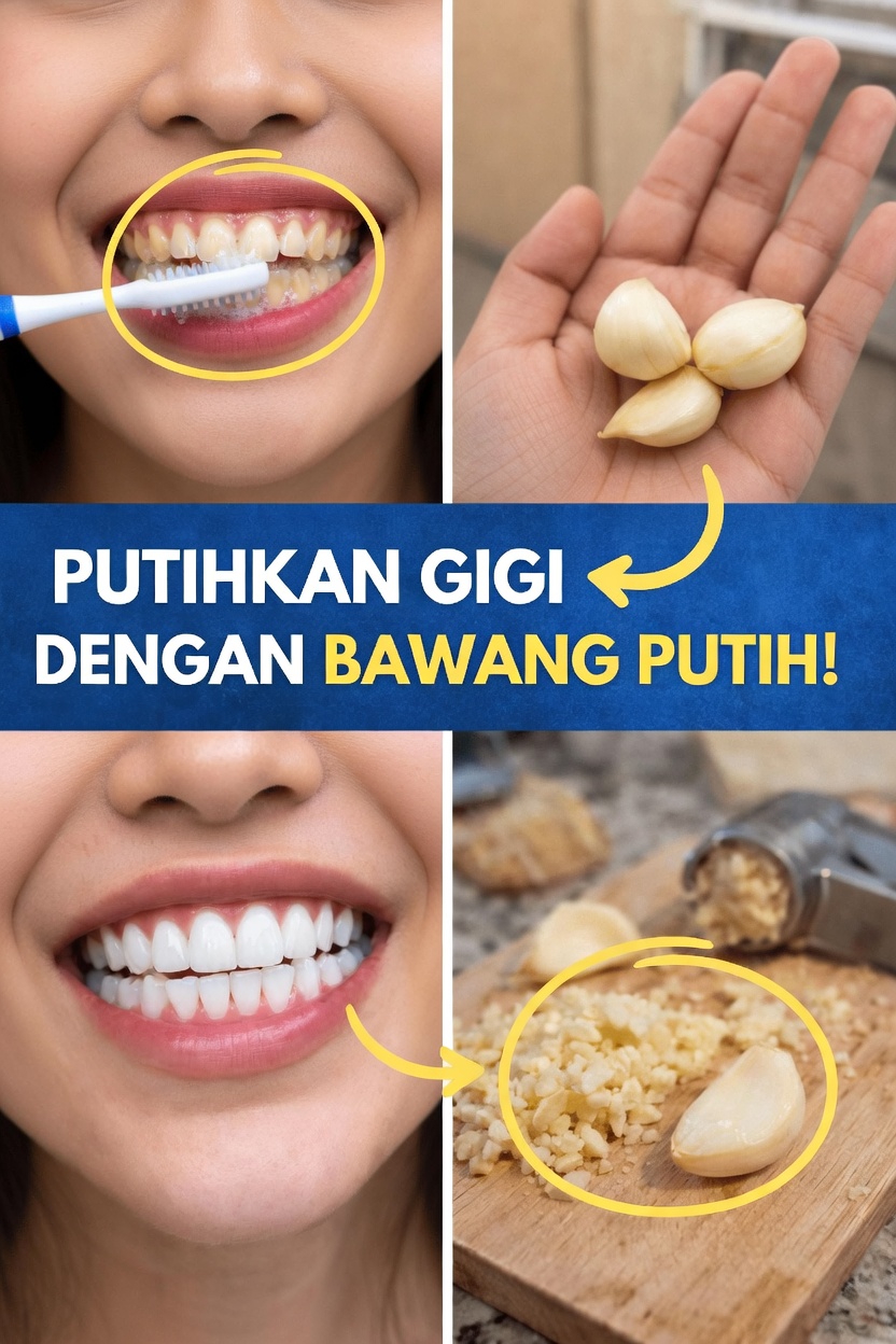 Benarkah Bawang Putih Dapat Membantu Memutihkan Gigi Anda dan Mendukung Senyum yang Lebih Cerah?