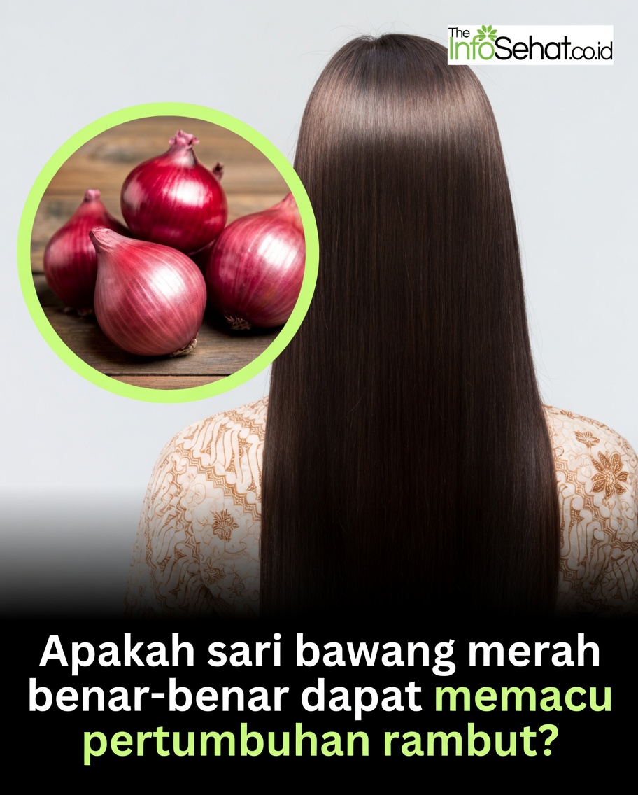Cara Menyiapkan Jus Bawang untuk Rutinitas Perawatan Rambut Anda: Tips untuk Pendekatan Rumahan yang Sederhana