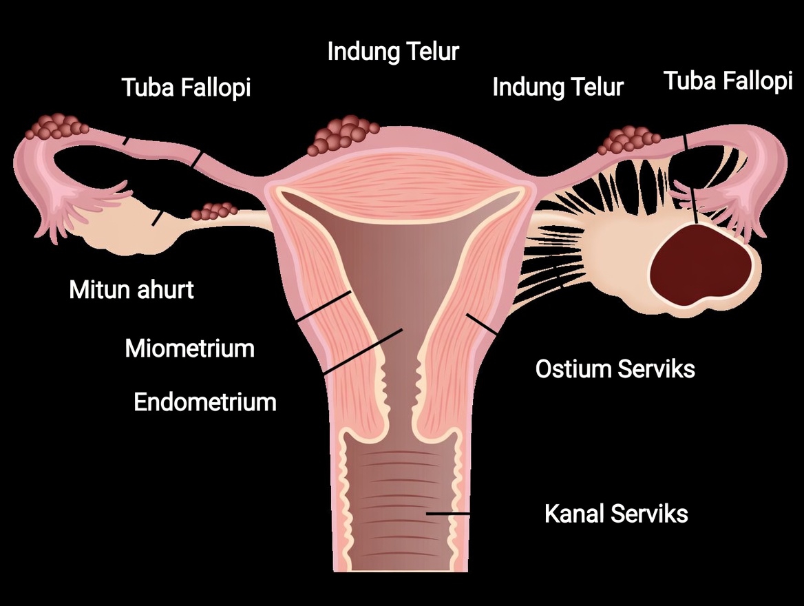 Peringatan Endometriosis: Kebiasaan Sehari-hari yang Tidak Boleh Anda Abaikan