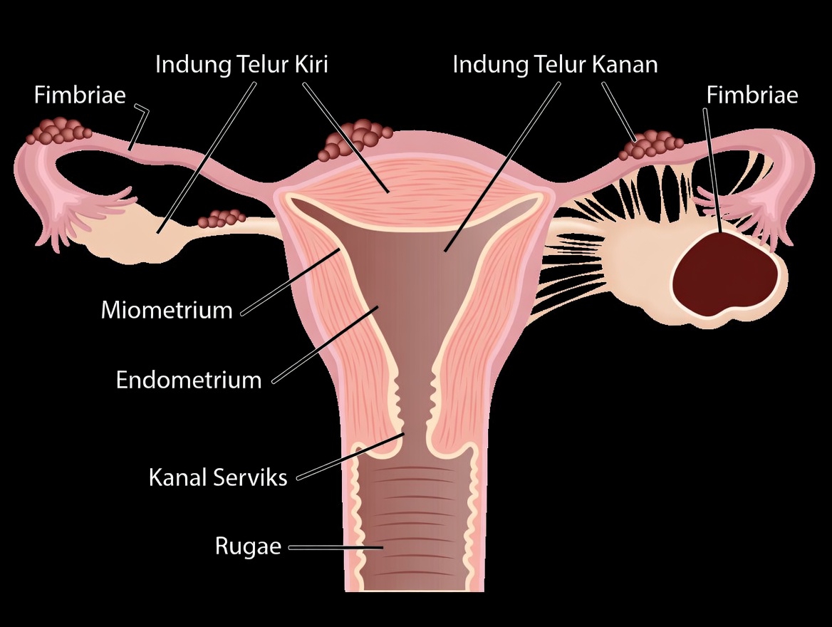 Peringatan Endometriosis: Kebiasaan Sehari-hari yang Tidak Boleh Anda Abaikan