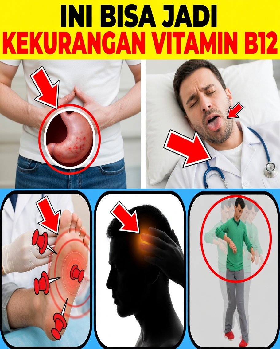 8 Tanda Aneh yang Menunjukkan bahwa Anda Mungkin Kekurangan Vitamin B12