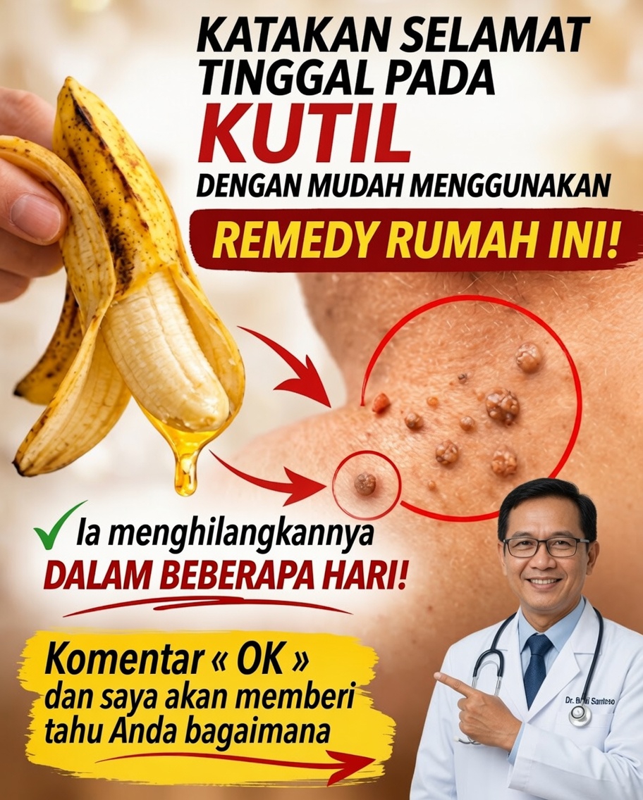 🍌 Perawatan kulit dengan kulit pisang: obat alami yang memikat para pencinta kecantikan