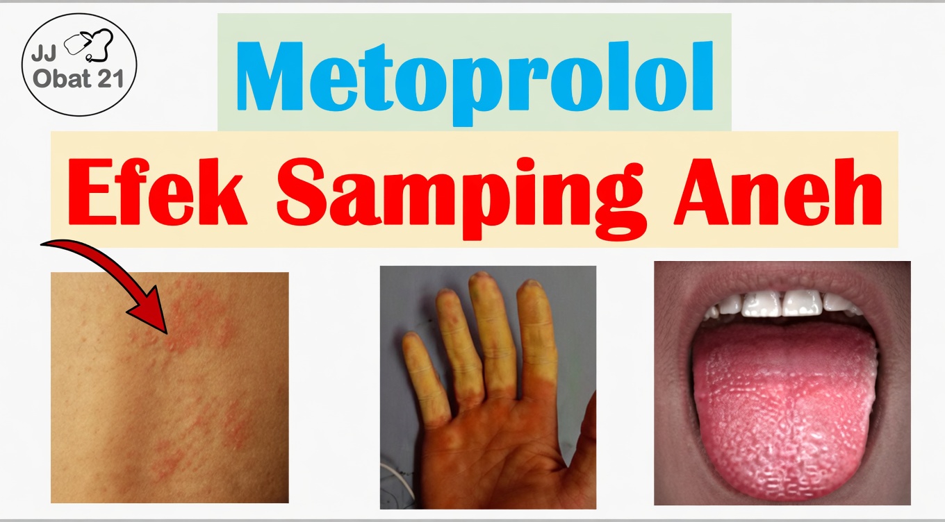 Apa 10 Efek Samping Umum Metoprolol dan Bagaimana Anda Dapat Mengenalinya Sejak Dini