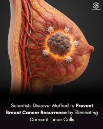 Apa yang Diungkap Penelitian Klinis Terkini tentang Menargetkan Sel Tumor Dorman dan Kekambuhan Kanker Payudara pada Para Penyintas