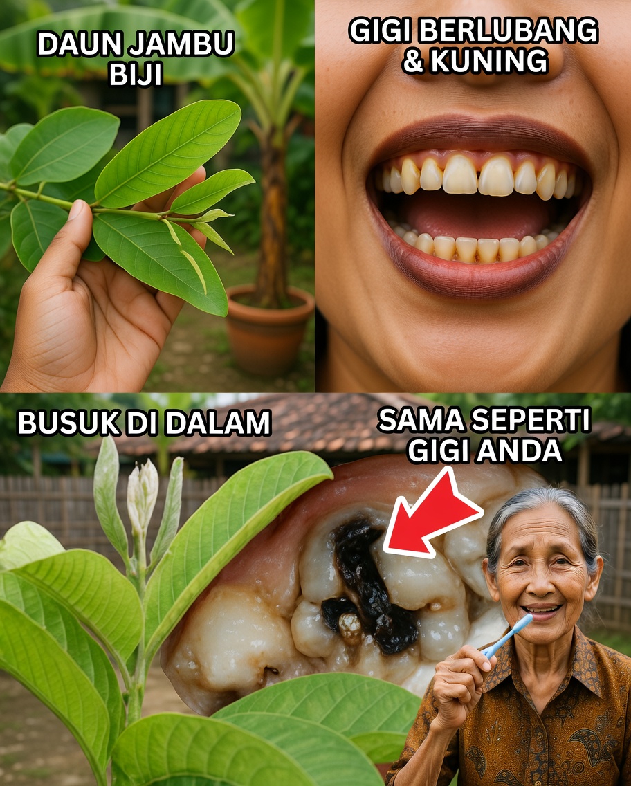 3 Cara Terbaik Mengobati Gigi Berlubang dengan Daun Jambu Biji – Sederhana dan Hemat Biaya