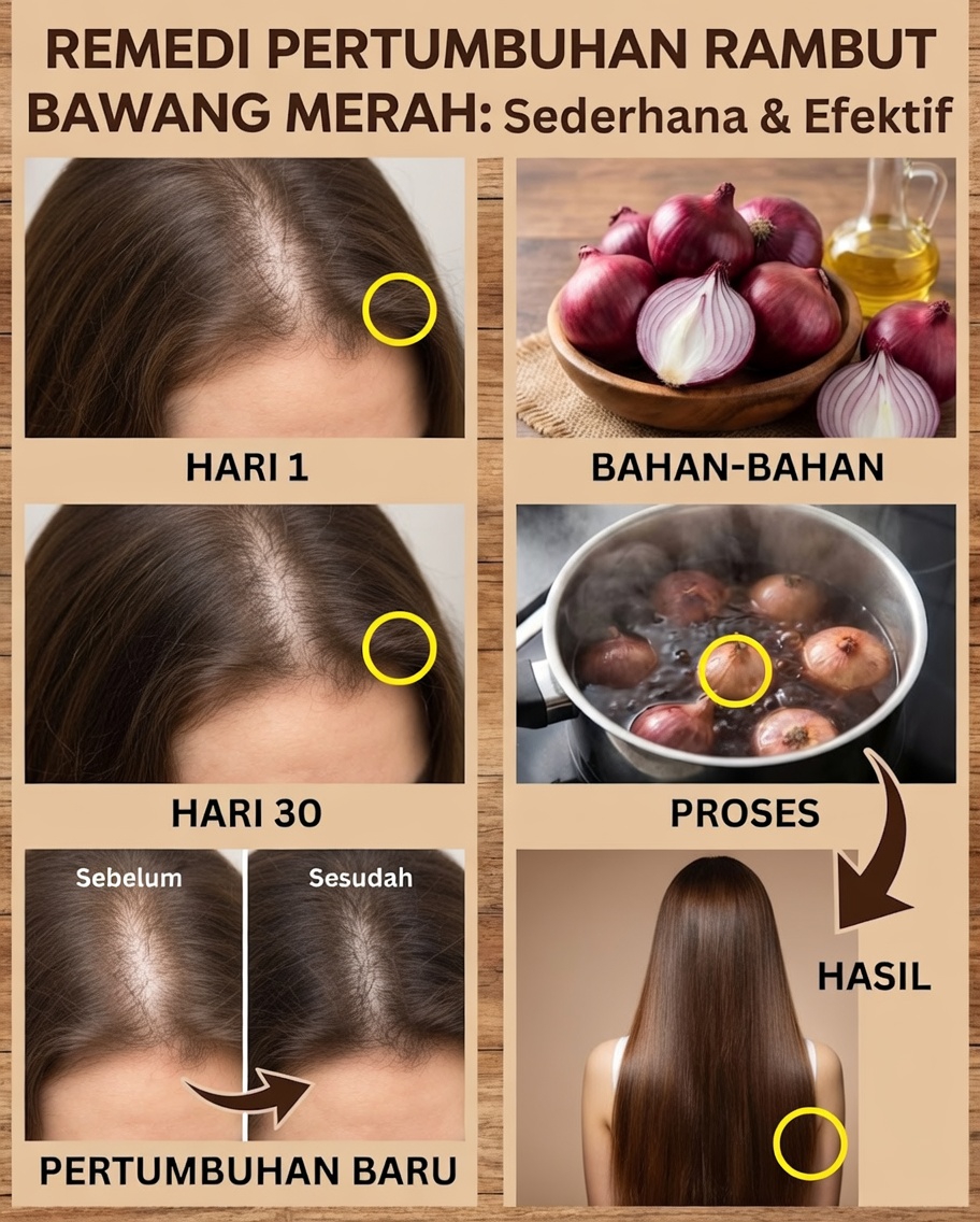 Mengapa Rutinitas Minyak Bawang Selama 1 Minggu Semakin Mendapat Perhatian dalam Perawatan Rambut Alami