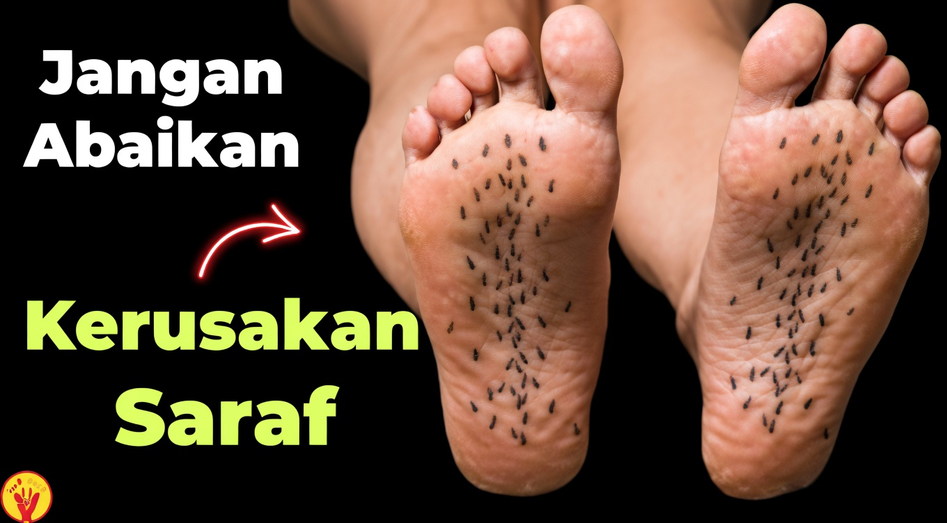 15 Tanda Peringatan Dini Kerusakan Saraf pada Kaki dan Tangan yang Harus Anda Perhatikan