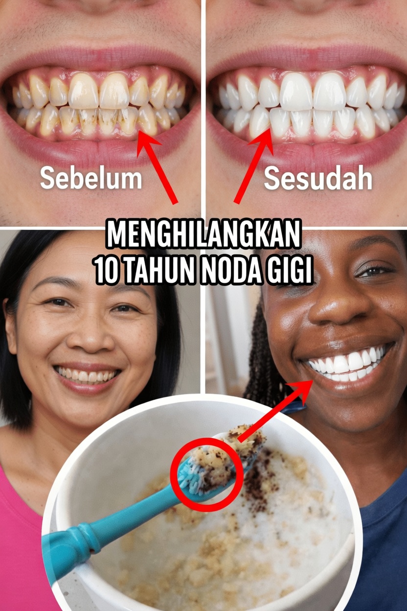 Mengapa Noda Permukaan Terjadi dan Mengapa Pemolesan Lembut Itu Penting