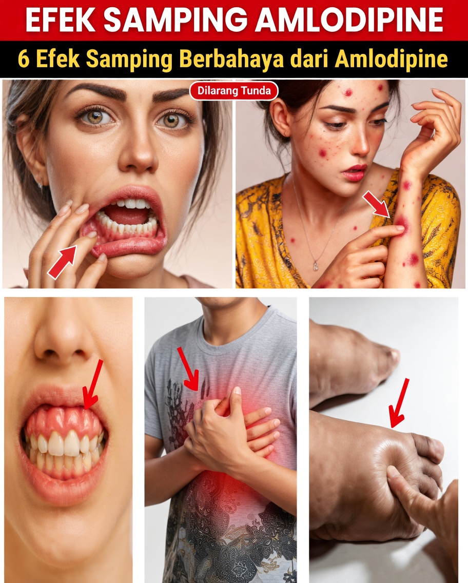 Apa Efek Samping Amlodipine yang Paling Umum dan Bagaimana Cara Mengatasinya?