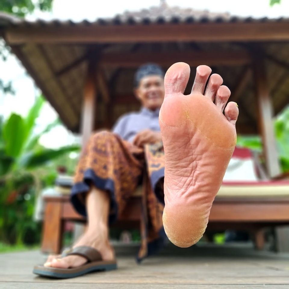 3 Tanda Mengkhawatirkan pada Kaki Anda yang Mengungkap Masalah Kesehatan Serius