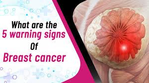 4 Tanda Peringatan Dini Kanker Payudara yang Harus Diketahui Setiap Wanita