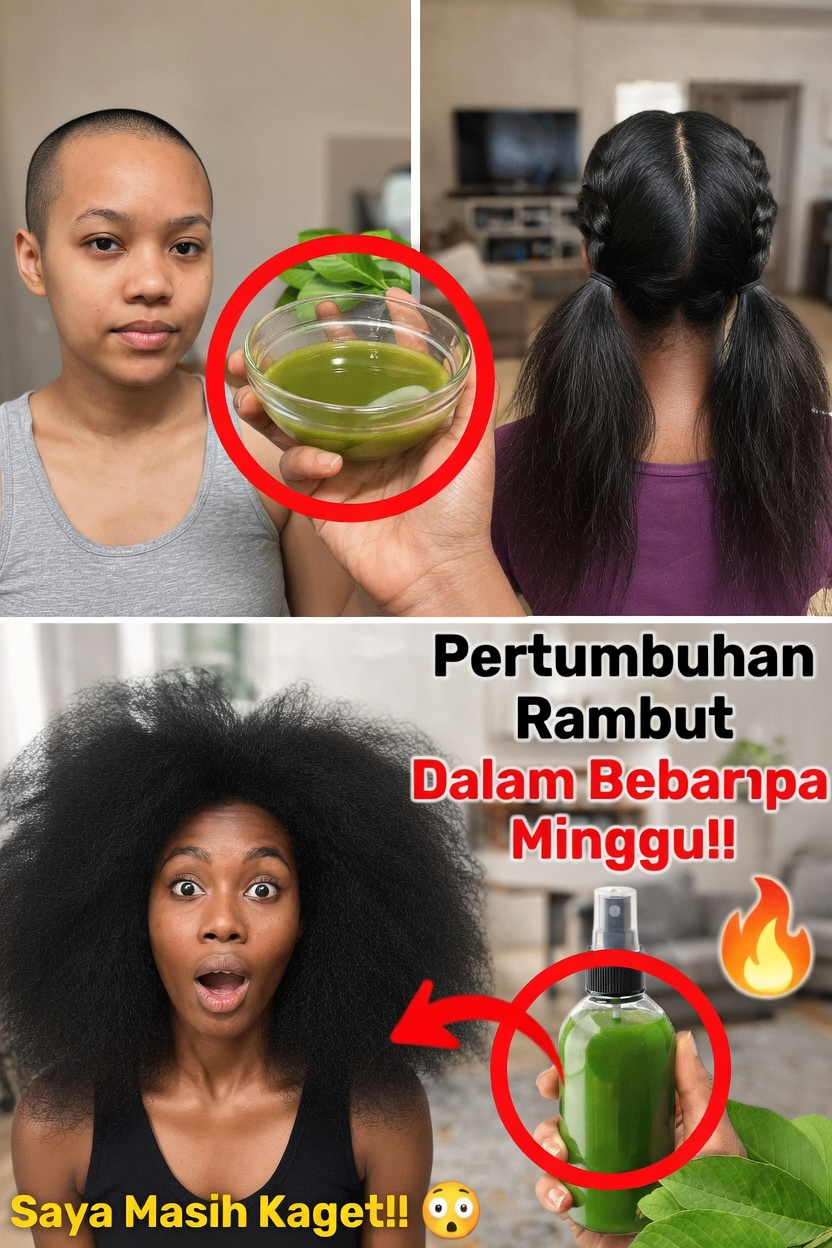 Dapatkah Daun Jambu Biji Mendukung Rambut yang Lebih Sehat? Menjelajahi Potensi Manfaat dan Cara Menggunakannya