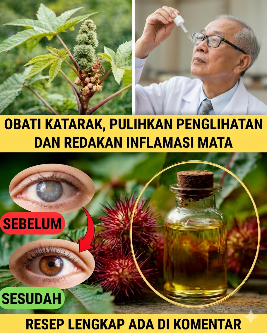 👁️ Minyak jarak untuk meningkatkan penglihatan: manfaat, mitos, dan penggunaan yang aman