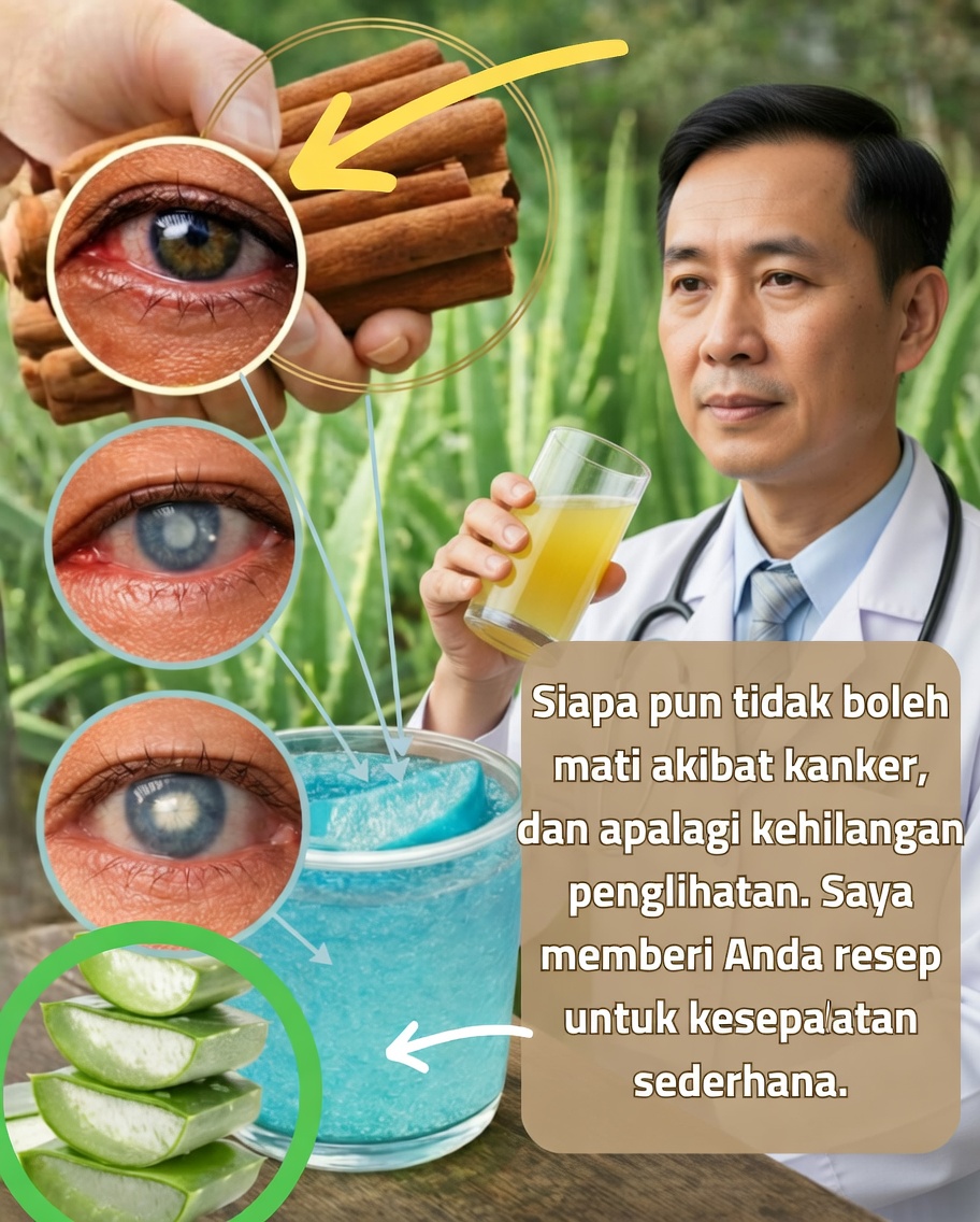 Aloe vera dan kayu manis: duo alami yang menjanjikan, tetapi perlu dicermati