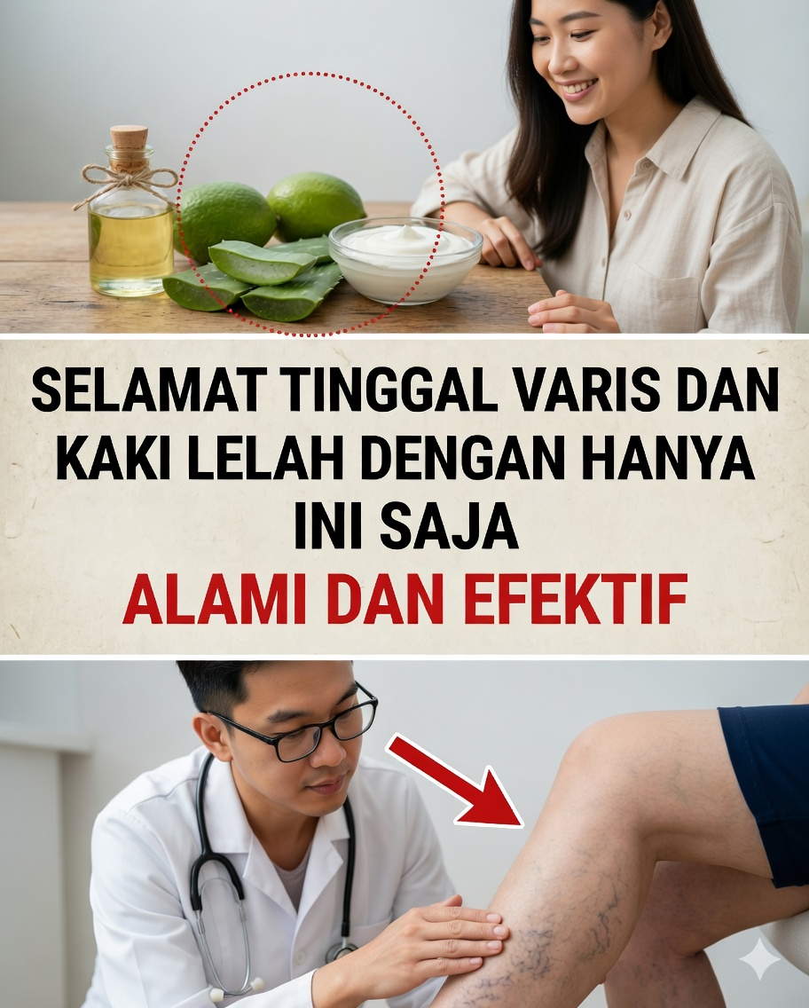 🧄🦵 Bawang putih dan varises: apakah obat alami ini benar-benar bekerja?