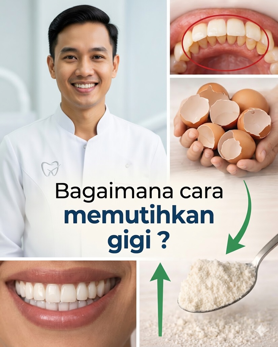 π¦· Rahasia alami untuk menghilangkan karang gigi dan memutihkan gigi di rumah