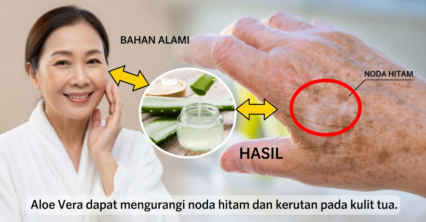 Cara Menghilangkan Noda di Tangan