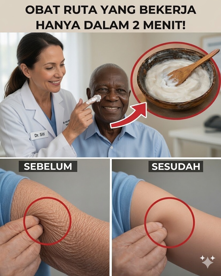 Obat Anti-Keriput untuk Lansia yang Bekerja Hanya dalam 2 Menit — Tanpa Bercanda!