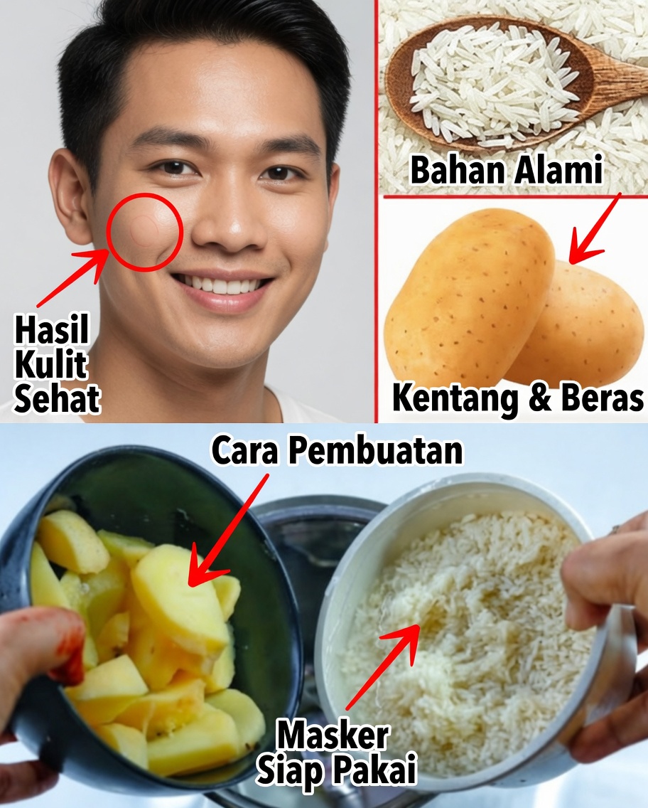 Rahasia Nasi dan Kentang: Cerahkan Kulit Anda dan Hapus Flek Hitam