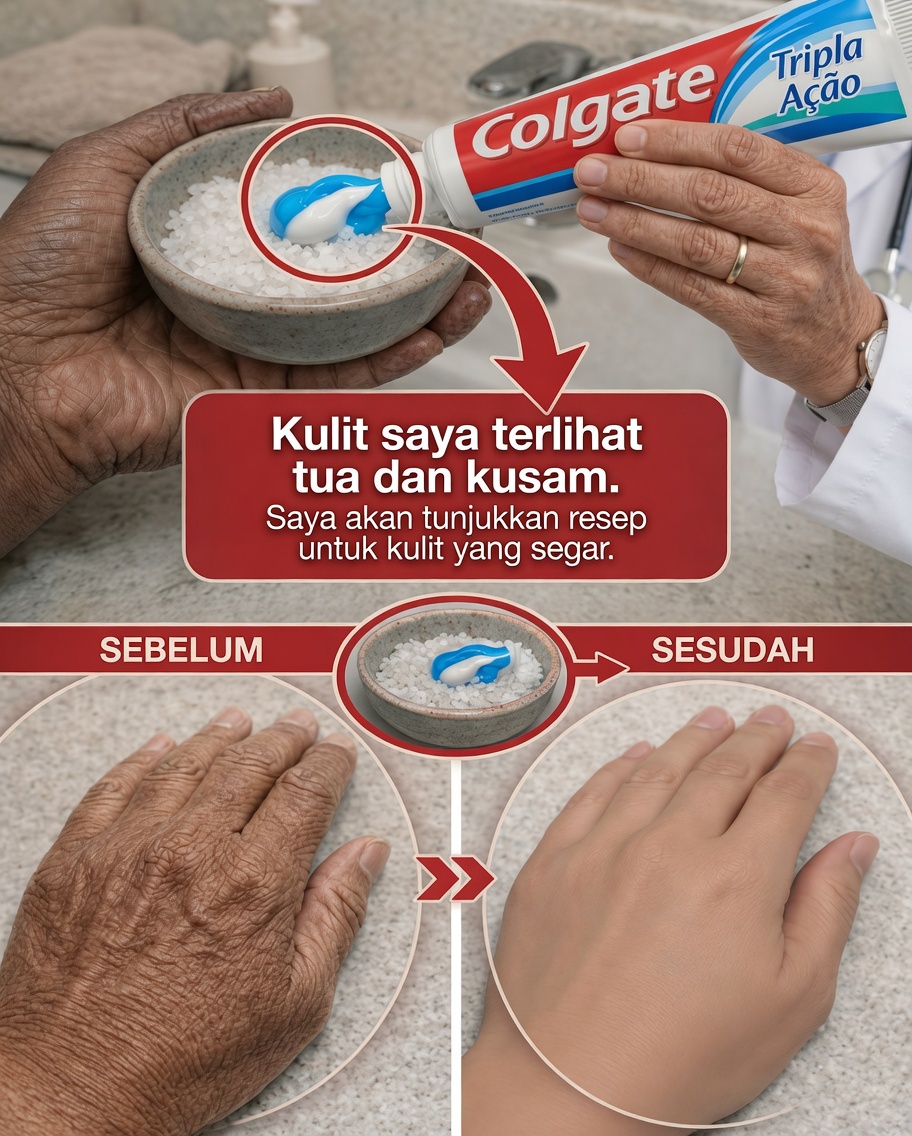 Mereka Mengira Aku Melakukan Prosedur Estetika… Padahal Hanya Rutinitas Sederhana Perawatan Alami untuk Kerutan dan Bercak di Tangan dan Lengan