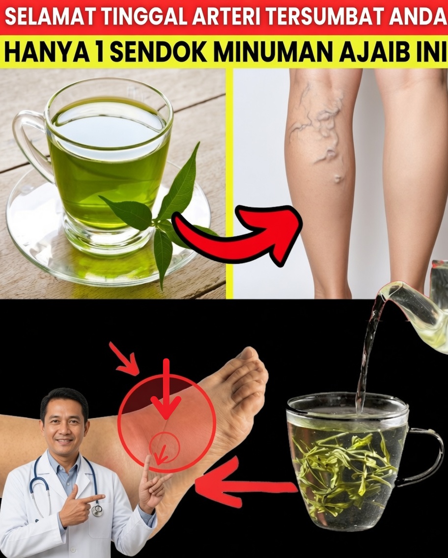 Berusia di Atas 60? Bersihkan dan Dukung Arteri Anda Secara Alami dengan Minuman Penyembuh yang Ampuh Ini