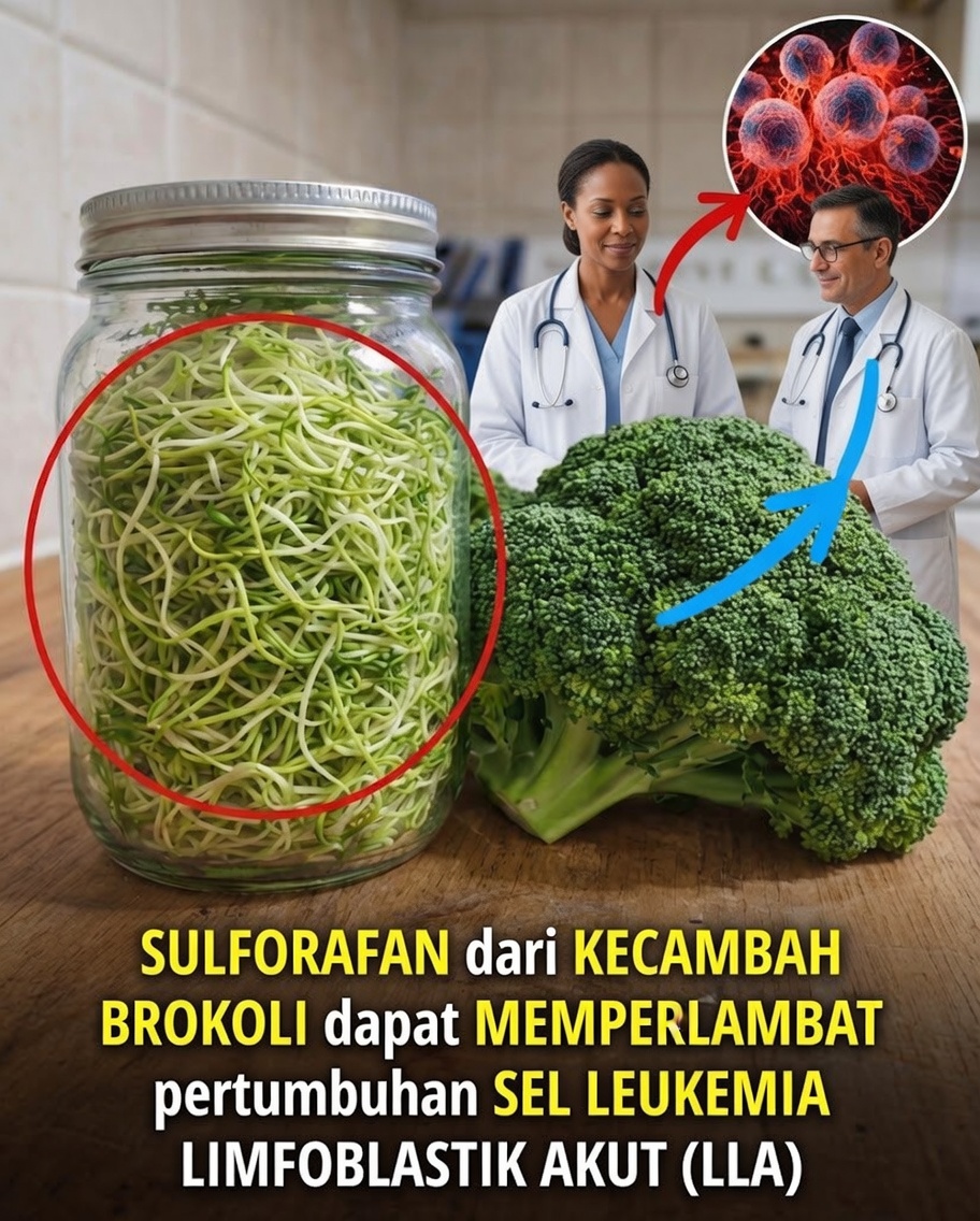 Dapatkah Senyawa dari Tanaman Umum Membawa Perspektif Baru dalam Dukungan terhadap Leukemia Limfoblastik Akut?