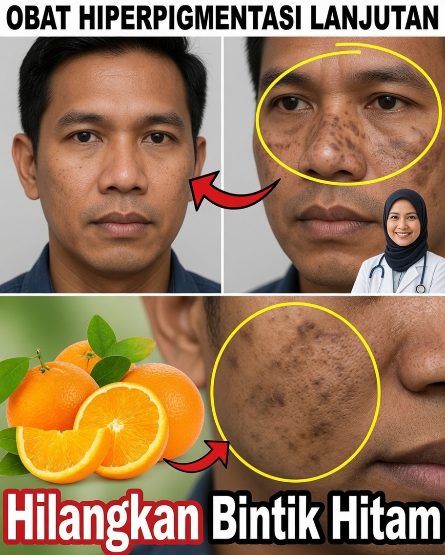 Nyalakan Kesehatan Anda: Ritual Lemon & Jahe Sederhana yang Dibutuhkan Tubuh Anda