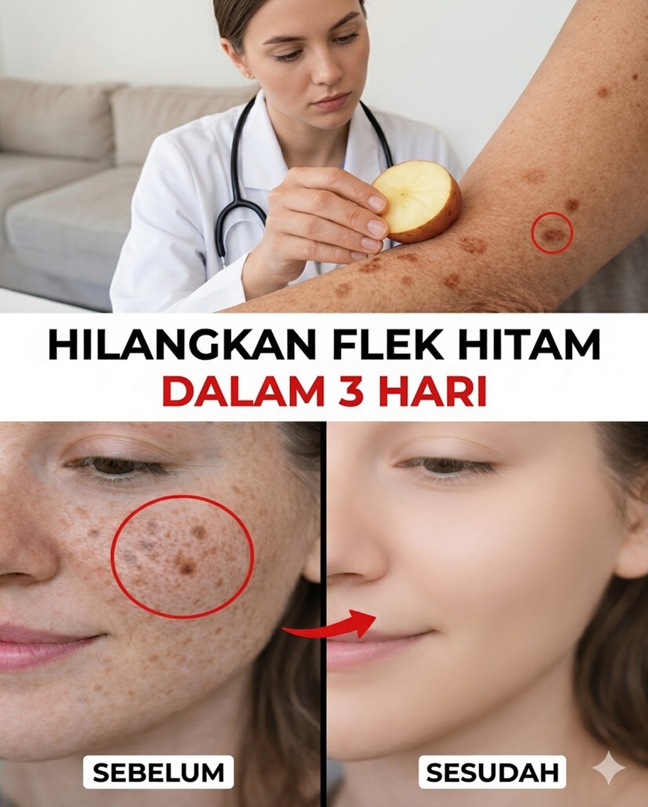 9 Cara Alami untuk Membantu Mengurangi Flek Penuaan, Melasma, Flek Matahari, dan Tanda-Tanda Penuaan