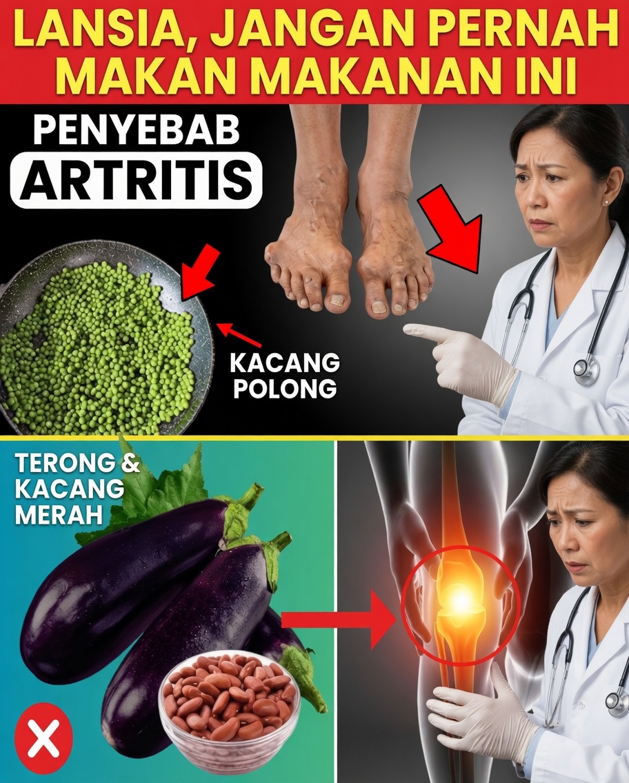 10 Makanan Tersembunyi yang Membuat Artritis Semakin Parah pada Lansia – Hindari Ini Mulai Hari Ini