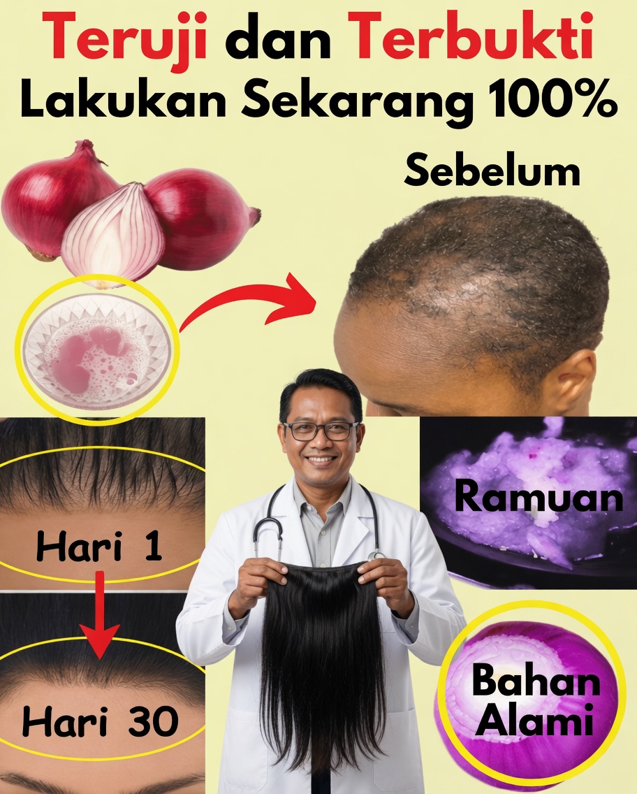 Minyak Bawang untuk Pertumbuhan Rambut: Pengobatan Alami Sederhana yang Benar-Benar Berhasil