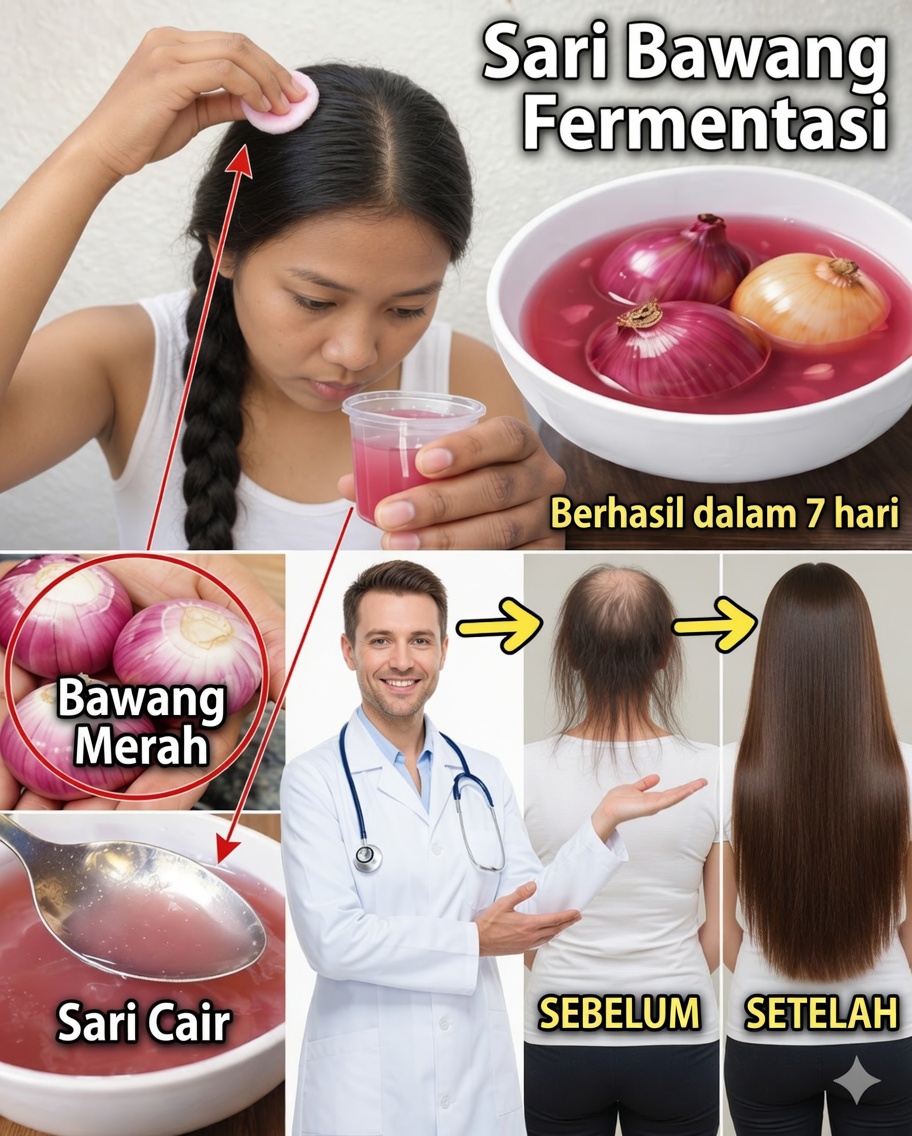 Jus Bawang Fermentasi: Rahasia Alami untuk Rambut Lebih Tebal, Kuat, dan Cepat Tumbuh