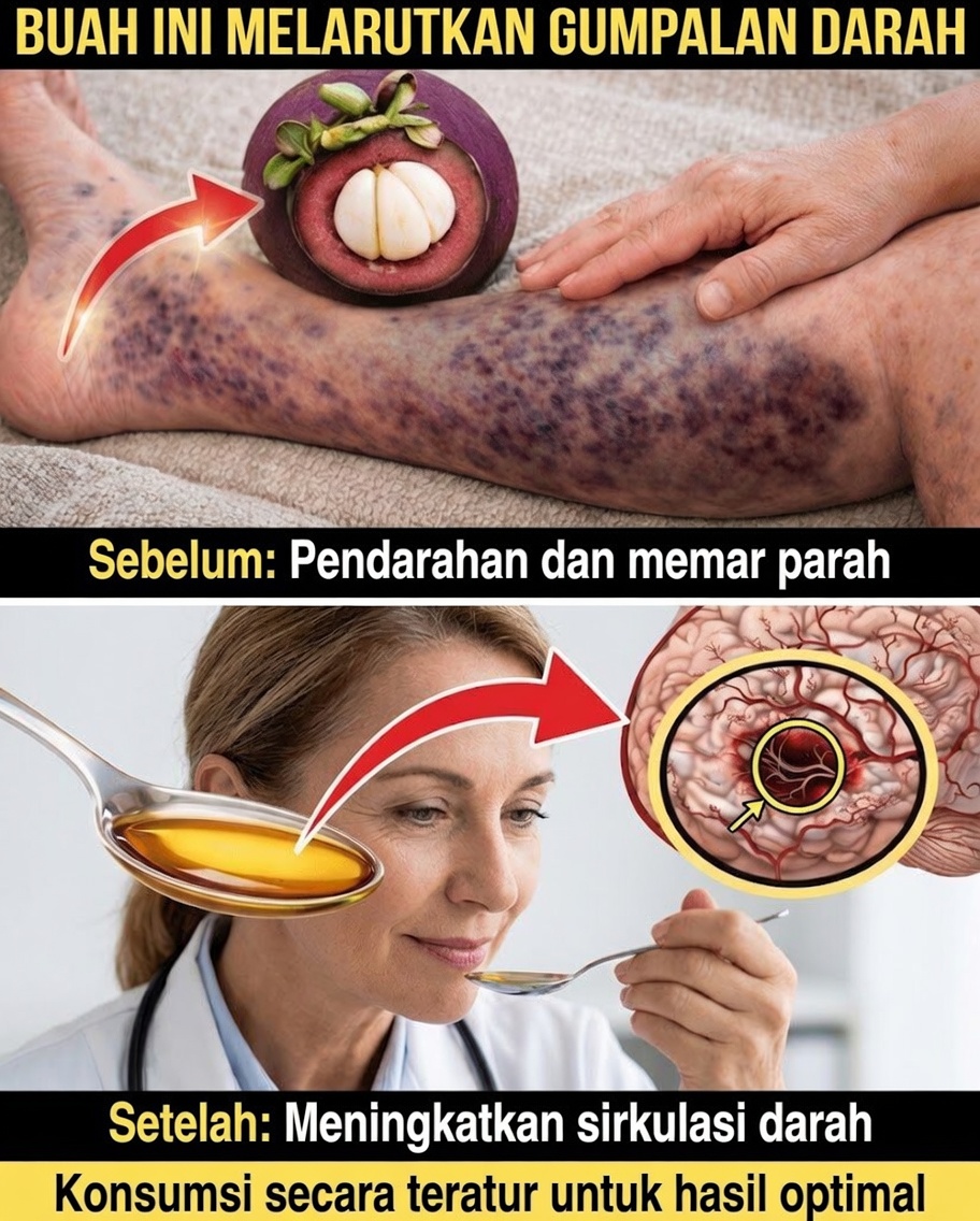 8 Buah Teratas yang Dapat Mendukung Sirkulasi Sehat dan Membantu Pencegahan Alami Pembekuan Darah