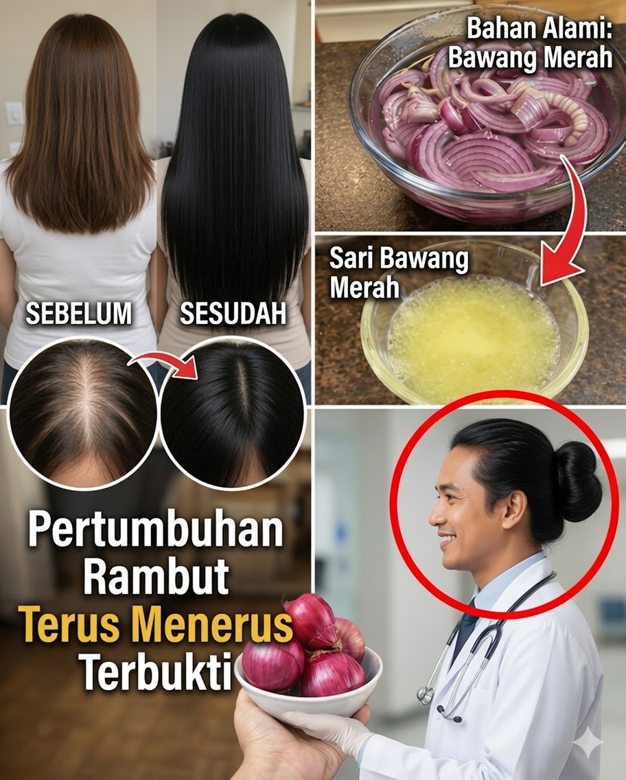 Cara Membuat Rambut Tumbuh Lebih Panjang dan Lebat dengan Bawang: Trik Kuno yang Hampir Tidak Ada yang Tahu
