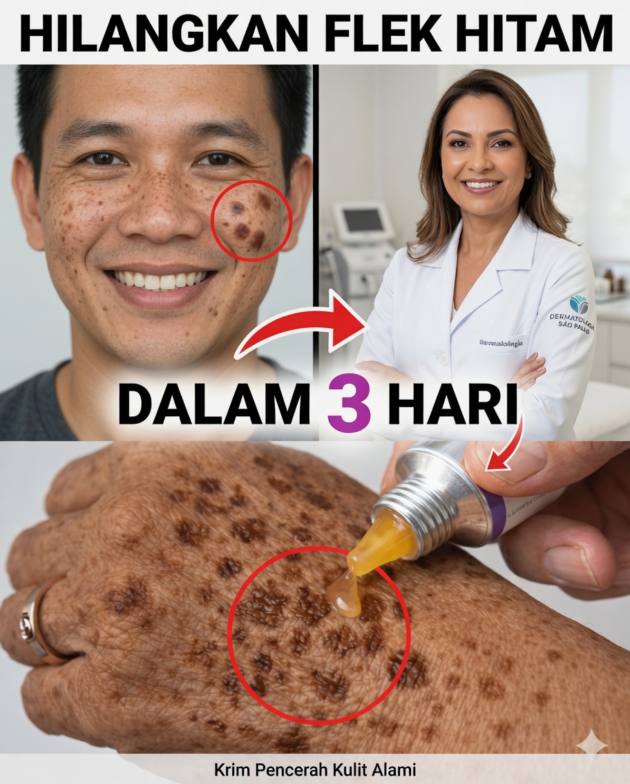 Hilangkan Bintik Penuaan Secara Alami: Masker Sederhana dari Tepung Maizena, Soda Kue, dan Lemon untuk Kulit yang Lebih Cerah dan Merata