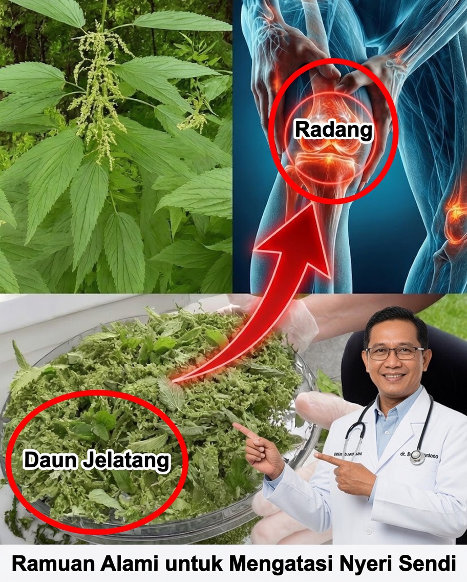 Kekuatan Urtica dioica: Jalan Alami untuk Meredakan Nyeri Sendi, Artritis, dan Peradangan
