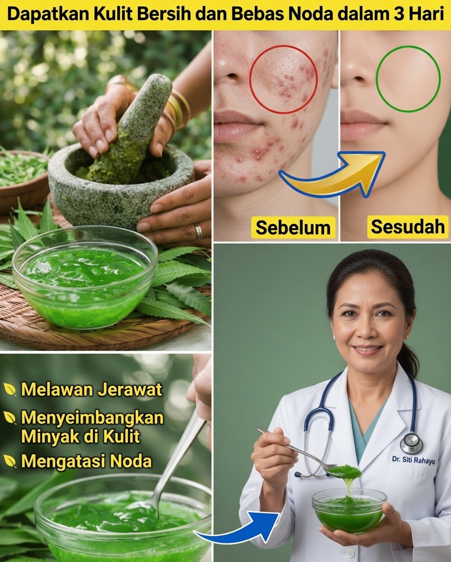 Cara Membuat dan Menggunakan Gel Neem Buatan Sendiri untuk Kulit yang Lebih Sehat di Rumah