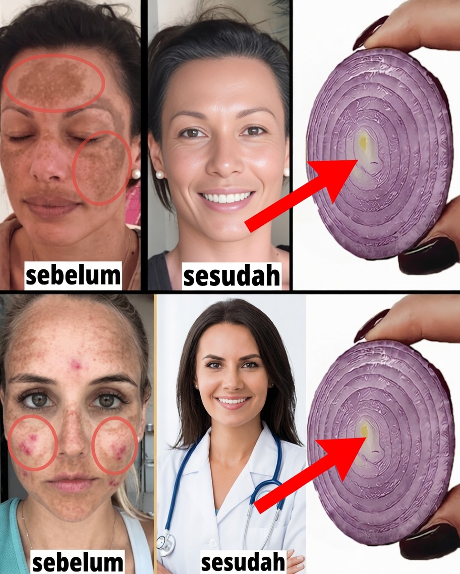 Campurkan Tepung Maizena dengan Bawang untuk Kulit Putih Seperti Salju dan Bening Seperti Kaca: Rahasia Alami yang Akan Membuat Anda Berharap Tahu Lebih Awal