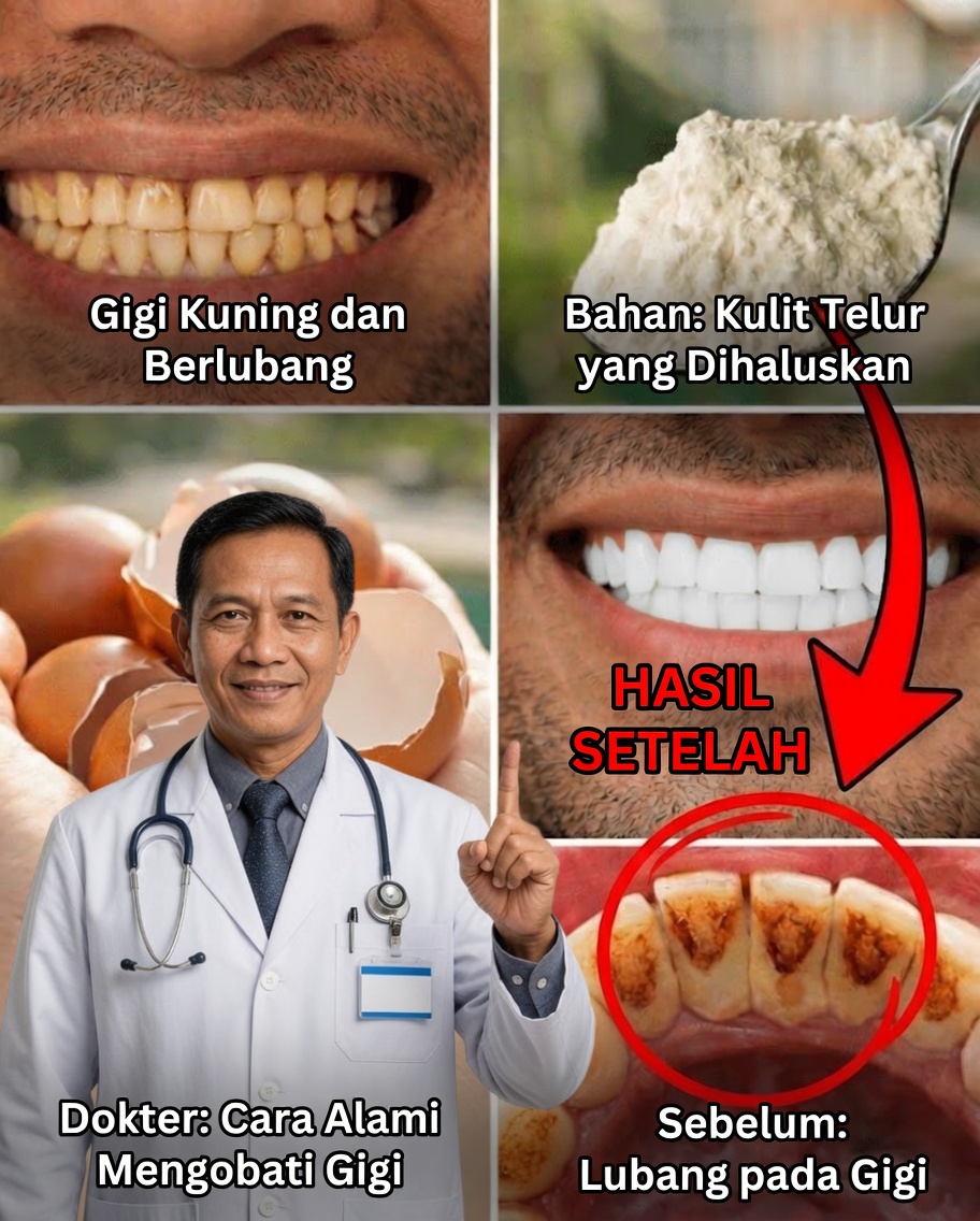 Uma Pendekatan Alami di Rumah yang Sedang Dicoba Banyak Orang untuk Gigi yang Lebih Bersih dan Lebih Cerah: Hal yang Perlu Diketahui tentang Cangkang Telur