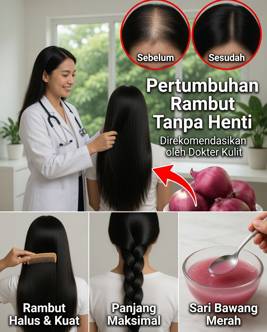 Cara Membuat Minyak Bawang di Rumah untuk Rambut Lebih Kuat dan Kulit Kepala yang Sehat