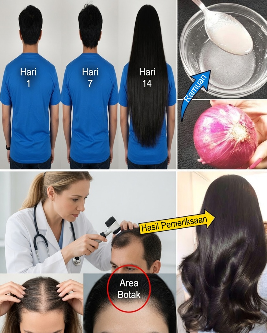 Buka Rahasia Pertumbuhan Rambut yang Ampuh Secara Alami dengan Jus Bawang Bombay – Rahasia yang Anda Harap Anda Temukan Lebih Awal