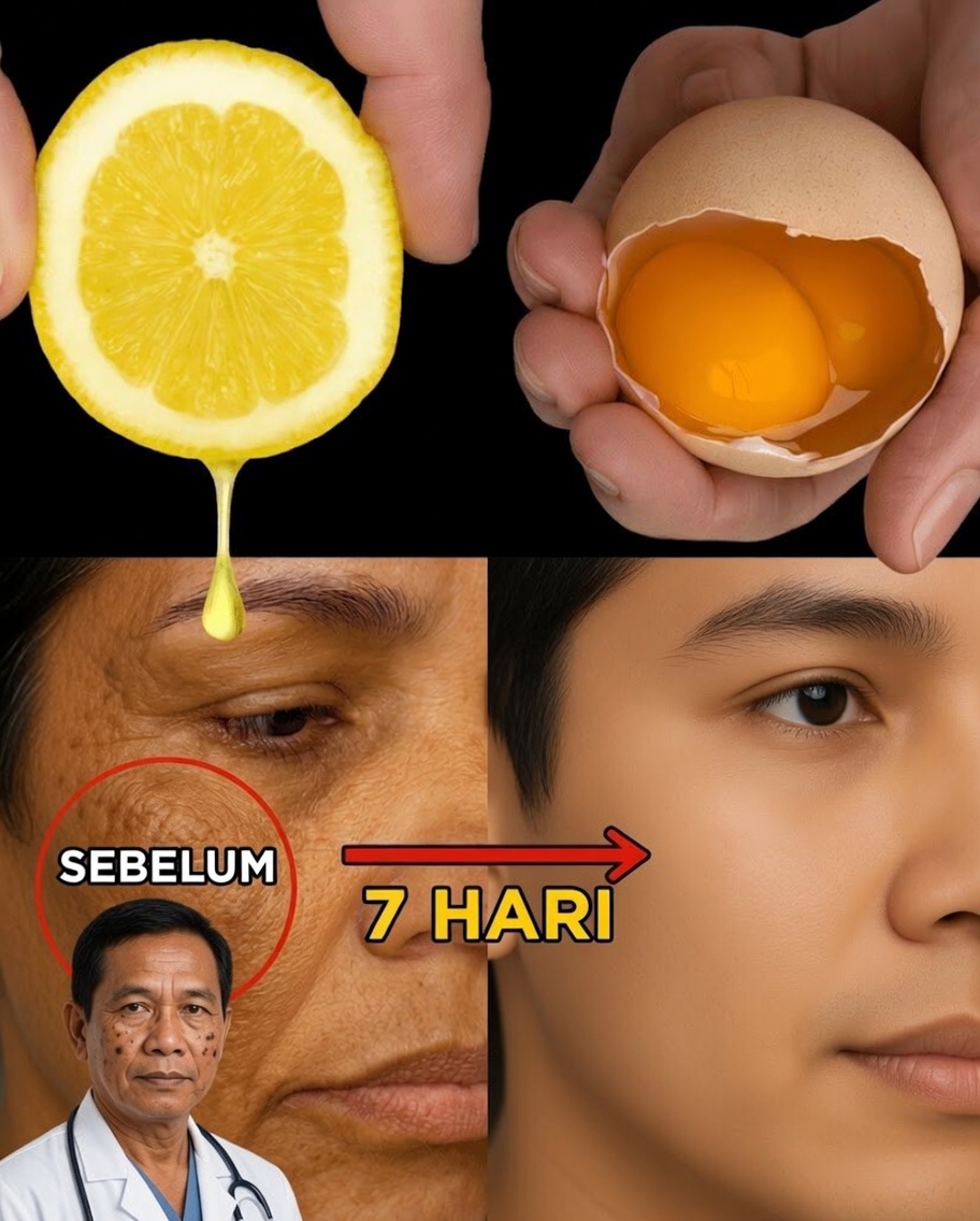 Campuran Lemon dan Telur untuk Kulit yang Tampak Awet Muda Secara Alami